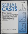 Serial Casts Their Use in the Management of SpasticityInduced Foot Deformity