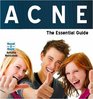 Acne  the Essential Guide