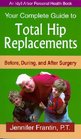 Your Complete Guide To Total Hip Replacements Before During And After Surgery