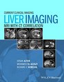 Liver Imaging MRI with CT Correlation