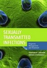 Sexually Transmitted Infections Diagnosis Management And Treatment
