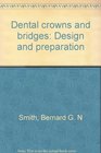 Dental crowns and bridges Design and preparation