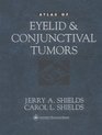 Atlas of Eyelid and Conjunctival Tumors