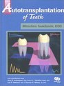 Autotransplantation of Teeth