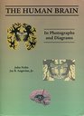 Human Brain In Photographs And Diagrams