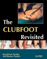 The Clubfoot Revisited