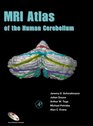 MRI Atlas of the Human Cerebellum