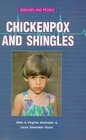 Chicken Pox and Shingles