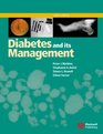 Diabetes and Its Management