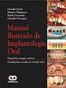 Manual Ilustrado de Implantologia Oral Diagnostico cirugia y protesis