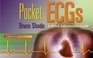 Pocket ECGs A Quick Information Guide