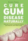 Cure Gum Disease Naturally Heal and Prevent Periodontal Disease and Gingivitis with Whole Foods