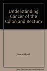 Understanding Cancer of the Colon and Rectum