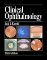 Clinical Ophthalmology A Systematic Approach