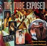 Tube Exposed