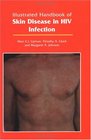 Illustrated Handbook of Skin Disease in HIV Infection