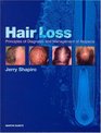 Hair Loss