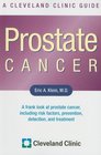 Prostate Cancer A Cleveland Clinic Guide