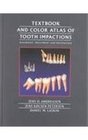 Textbook and Color Atlas of Tooth Impactions Diagnosis Treatment Prevention