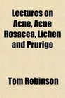 Lectures on Acne Acne Rosacea Lichen and Prurigo