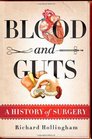 Blood and Guts A History of Surgery