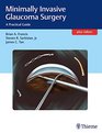 Minimally Invasive Glaucoma Surgery A Practical Guide