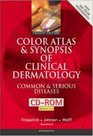 Color Atlas  Synopsis of Clinical Dermatology Common  Serious Diseases