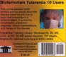 Bioterrorism Tularemia 10 Users