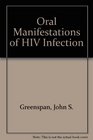 Oral Manifestations of HIV Infection