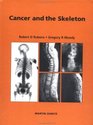 Cancer and the Skeleton