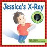 Jessica's X-Ray: Includes Actual X-Rays!