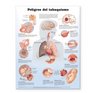 Dangers of Smoking Anatomical Chart in Spanish