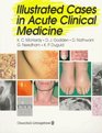 Illustrated Cases in Acute Clinical Medicine