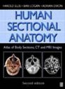 Human Sectional Anatomy Atlas of Body Sections CT and MRI Images