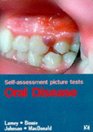 SelfAssessment Picture Tests Oral Disease