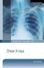 Pocket Guide to Chest Xrays