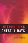 Interpreting Chest Xrays