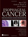 Esophageal Cancer Principles and Practice