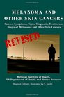 Melanoma And Other Skin Cancers Causes Symptoms Signs Diagnosis Treatments Stages of Melanoma and Other Skin Cancers