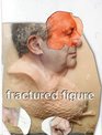 Fractured Figure Volume I