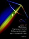 An Atlas of Multiplane Transesophageal Echocardiography 2 Volume Set
