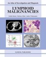 Lymphoid Malignancies An Atlas of Investigation and Management