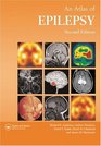Atlas of Epilepsy Second Edition