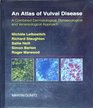An Atlas of Vulval Diseases A Combined Dermatological Gynecological  Venereological Approach