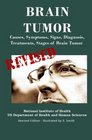 Brain Tumor Causes Symptoms Signs Diagnosis Treatments Stages of Brain Tumor  Revised Edition  Illustrated by S Smith