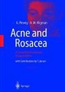 Acne and Rosacea