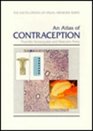 Atlas of Contraception Second Edition