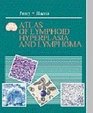 Atlas of Lymphoid Hyperplasia and Lymphoma