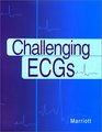 Challenging ECGs