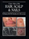 Color Atlas of the Hair Scalp and Nails